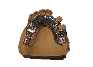 Explore Permanent Partial Dentures and Their Costs in Brisbane