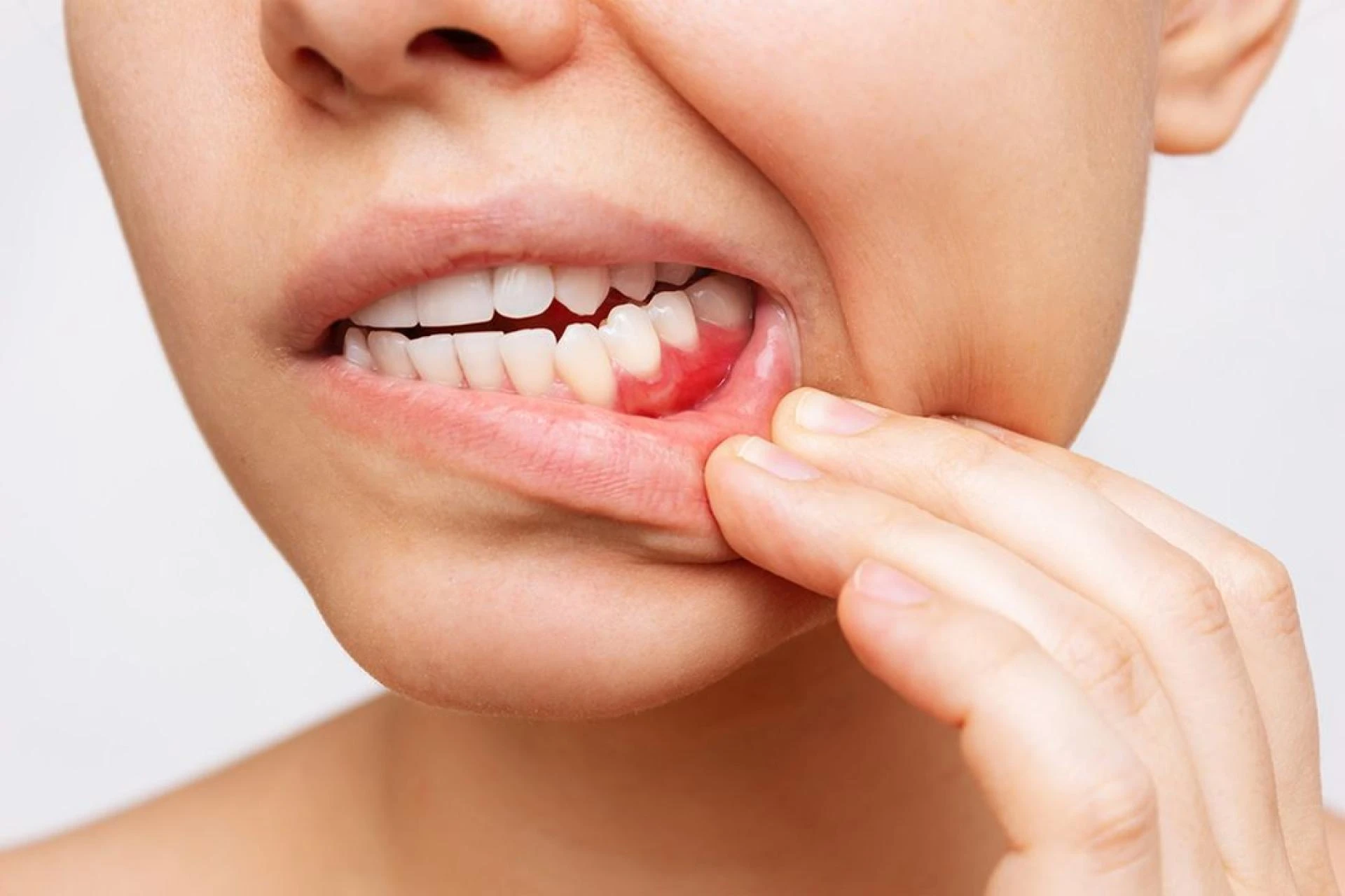 5 Life-Changing Benefits of Periodontal Treatment 
