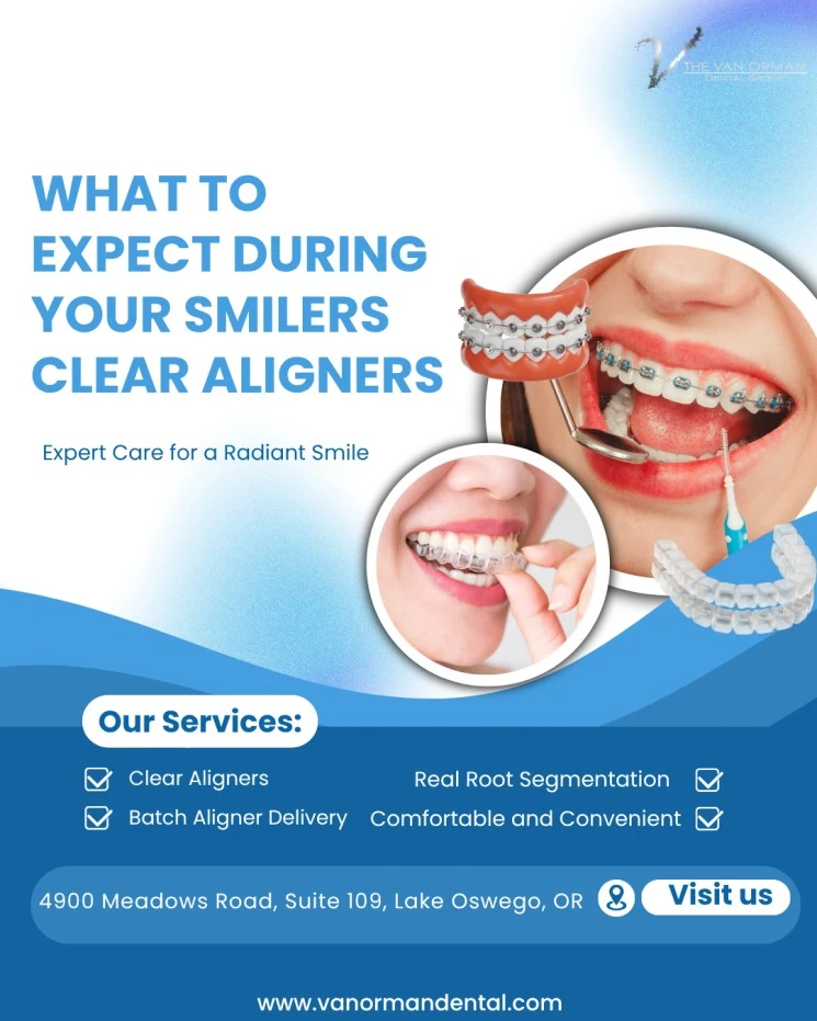 What to Expect During Your Smilers Clear Aligners Journey