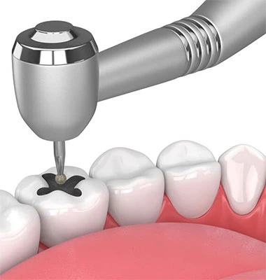 Affordable and Quality Care at Care Dental – Your Path to Free Dental Care in Auckland
