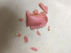 Emergency Denture Repair and Mobile Services for Your Convenience