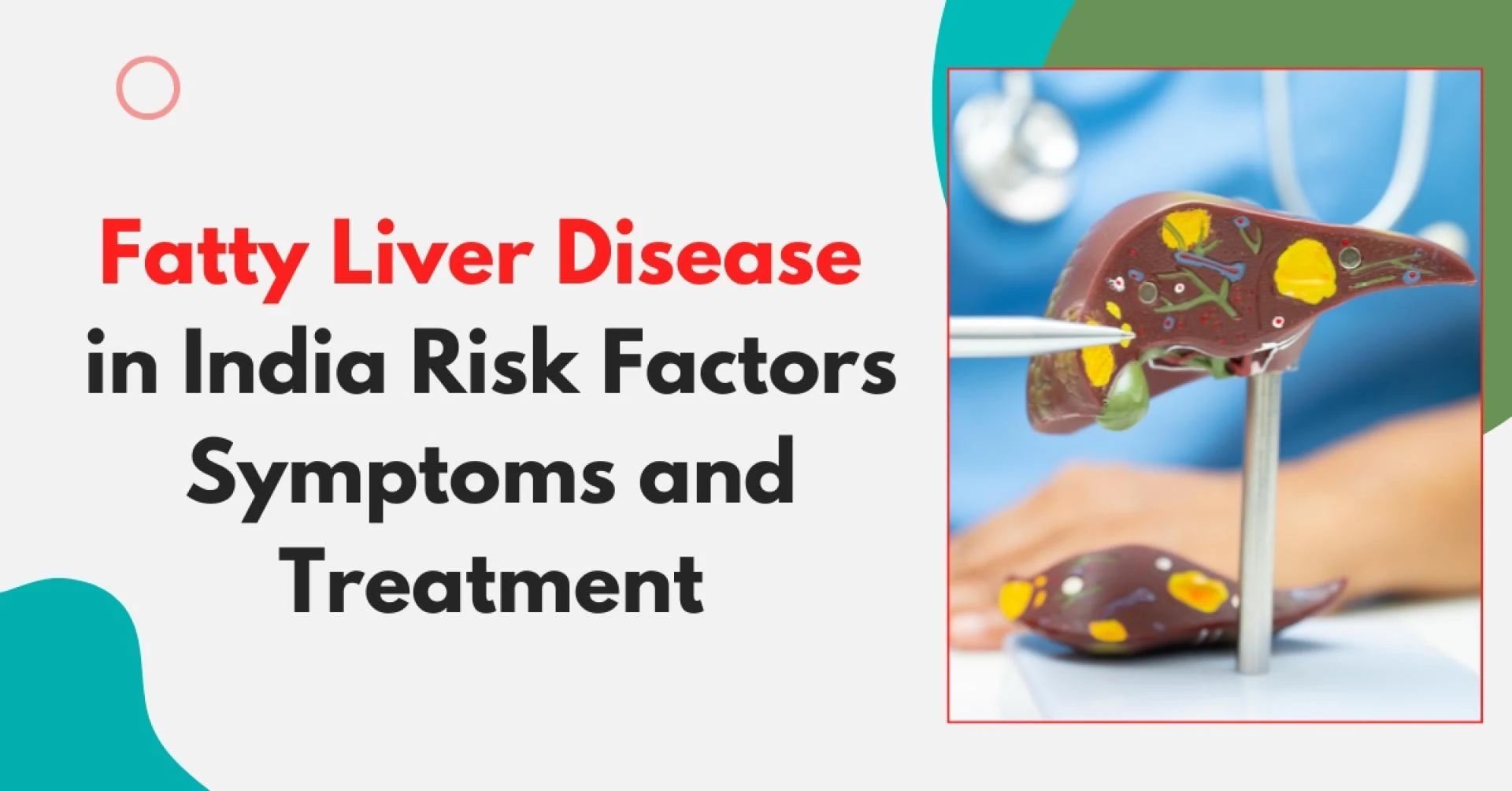 Fatty Liver Disease in India Risk Factors Symptoms and Treatment