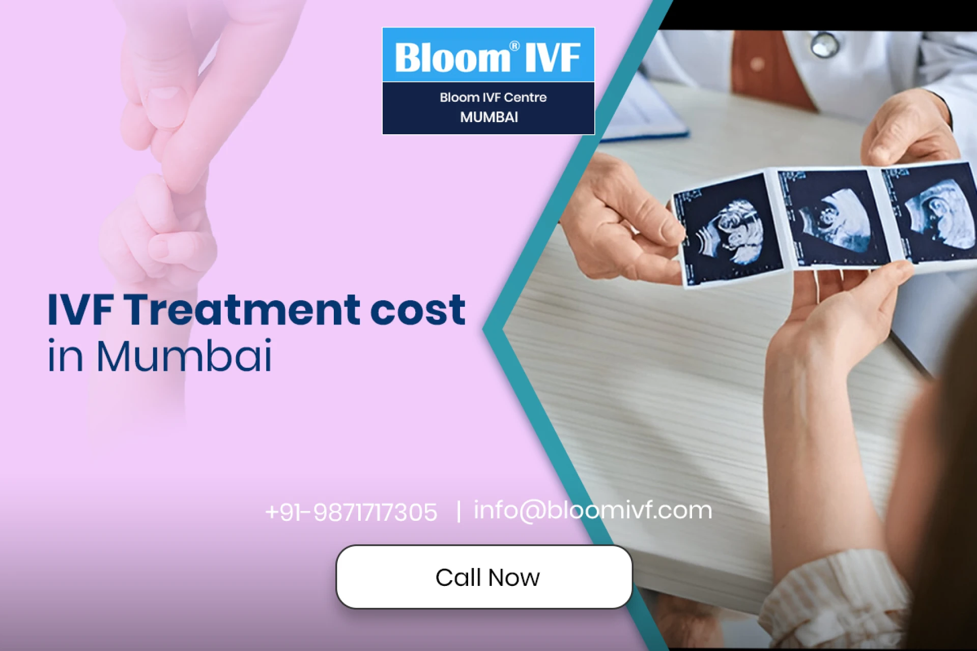 IVF Treatment Cost in Mumbai: A Comprehensive Guide by Bloom IVF