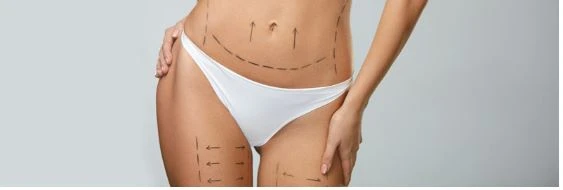 Premier Liposuction Clinic in Los Angeles: Safe, Effective, and Customized Body Sculpting Solutions from Trusted Experts