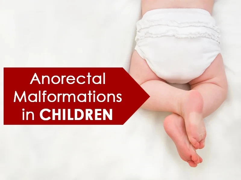 Anorectal Malformation in India: Diagnosis, Surgery, and Long-Term Care