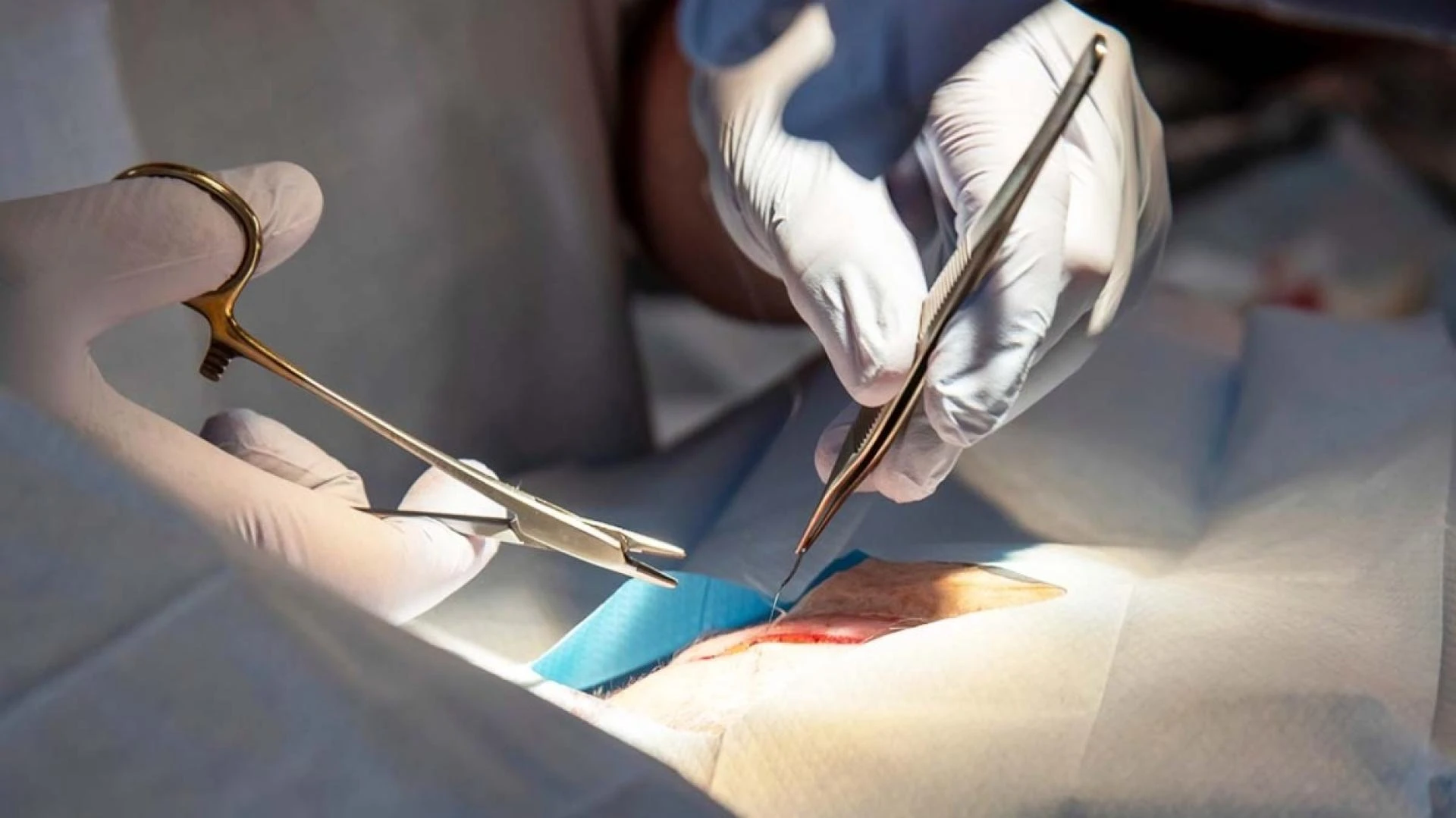 Finding the Right Cancer Surgeon in Delhi: A Vital Step Towards Healing
