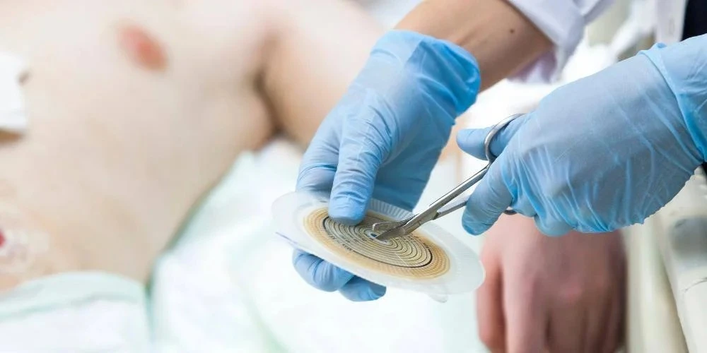 Finding the Right Cancer Surgeon in Delhi: A Vital Step Towards Healing