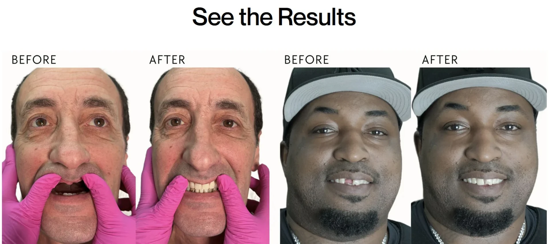 Choosing the Right Tooth Replacement: What You Should Know