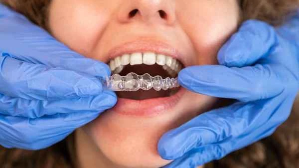 Discover Your Best Smile with Support from Invisalign Specialists
