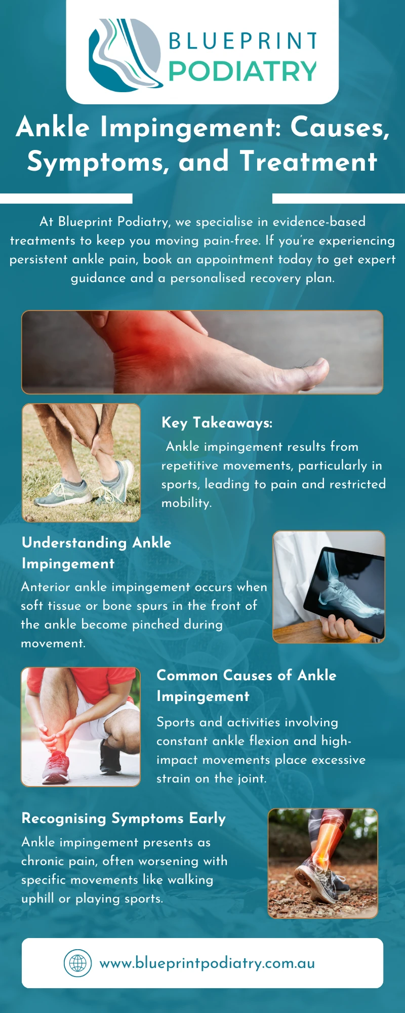 Understanding Ankle Impingement – Causes, Signs & Treatment Options