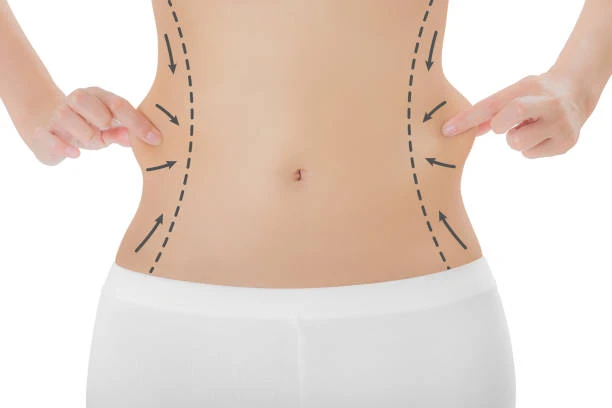 Lipo Abdominoplasty: What Makes It Different and Effective