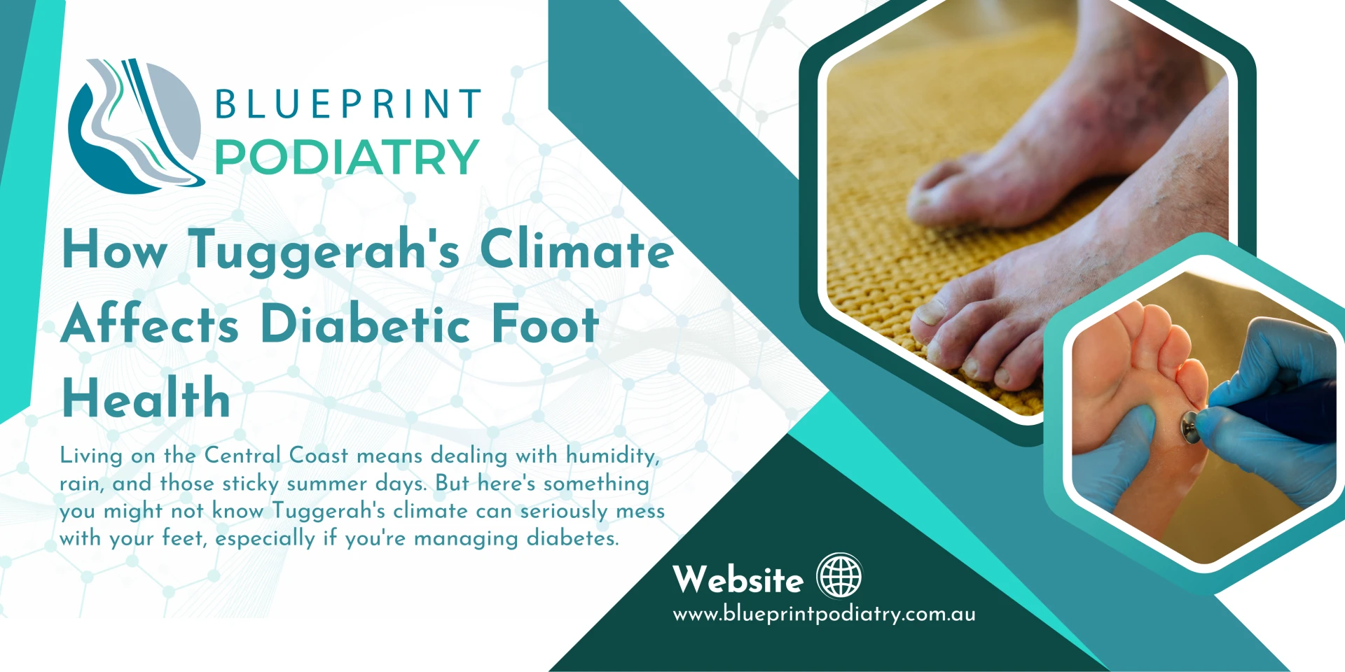 How Tuggerah's Climate Affects Diabetic Foot Health