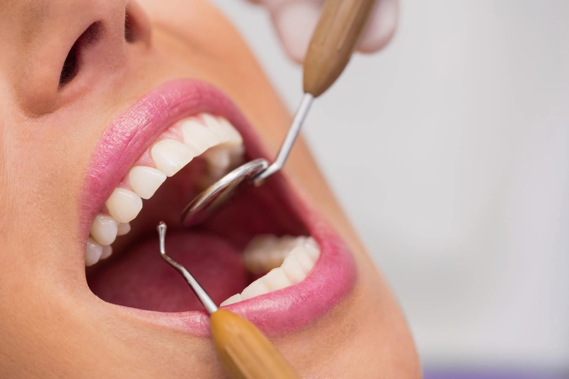 Why Regular Dental Check-Ups Are Essential for a Healthy Smile