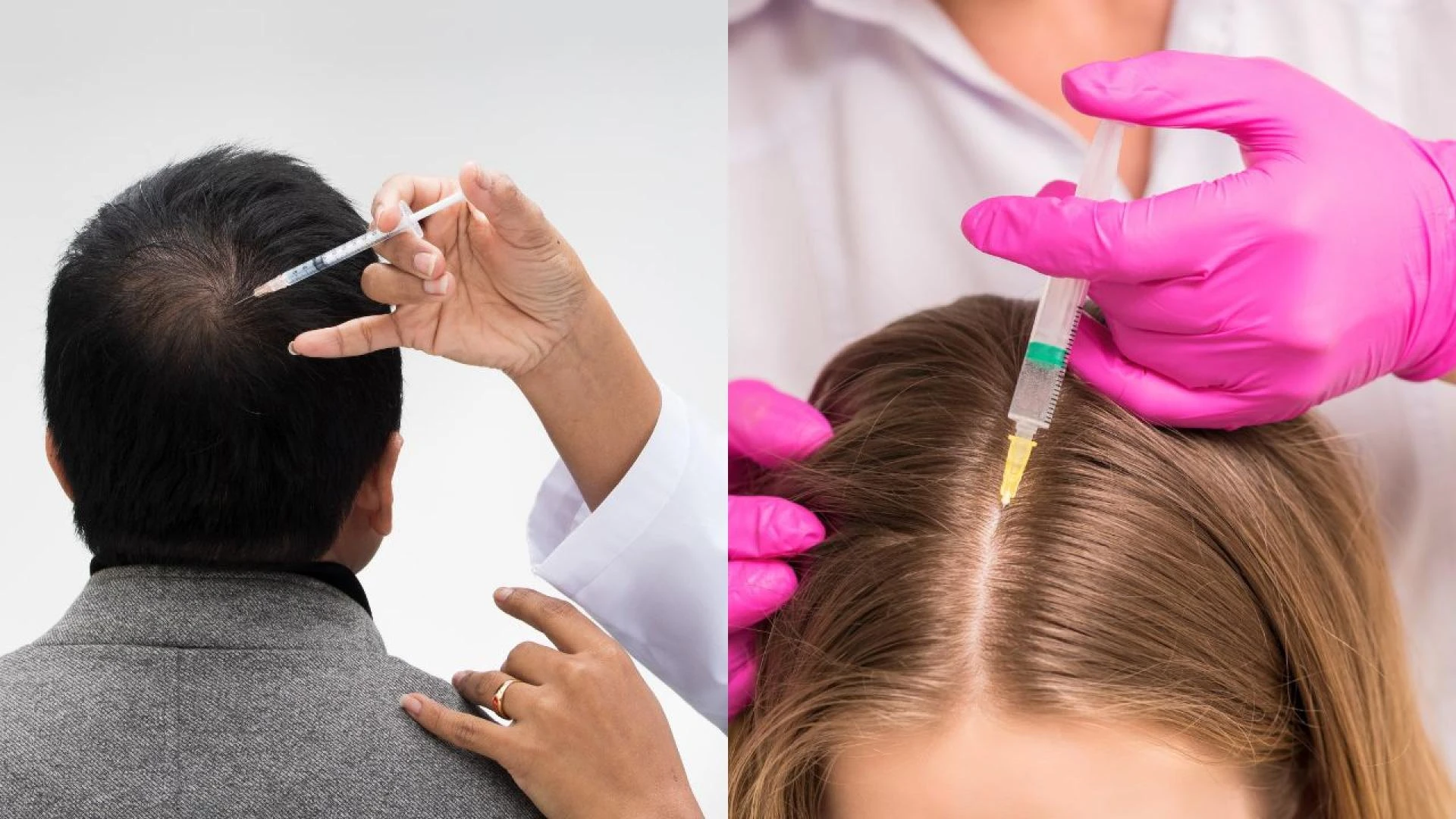 Effective Hair Fall Solution for Healthy Growth