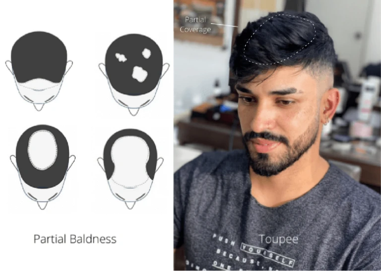 Buying Your First Frontal Hair System: A Complete Guide