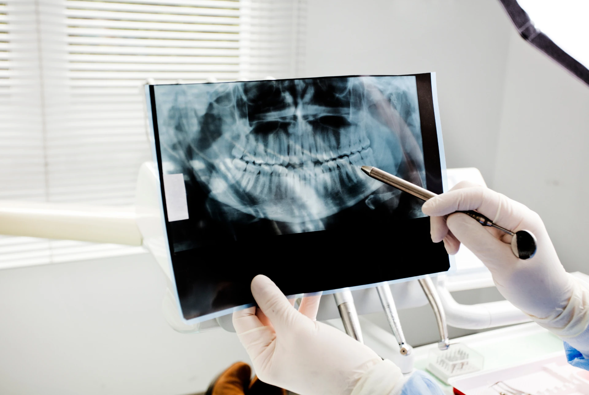 Preventive Cooloongup Dental Care: Why Regular Check-Ups Matter