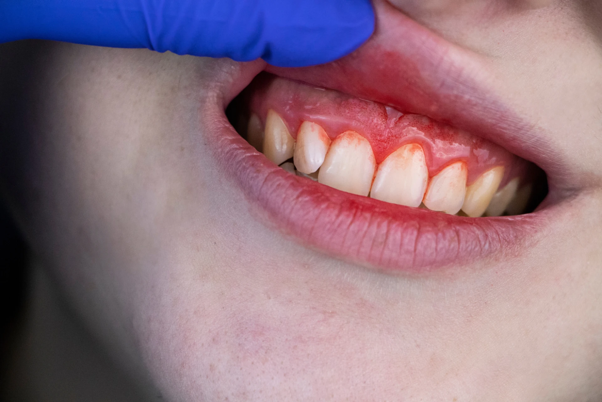 Preventive Cooloongup Dental Care: Why Regular Check-Ups Matter