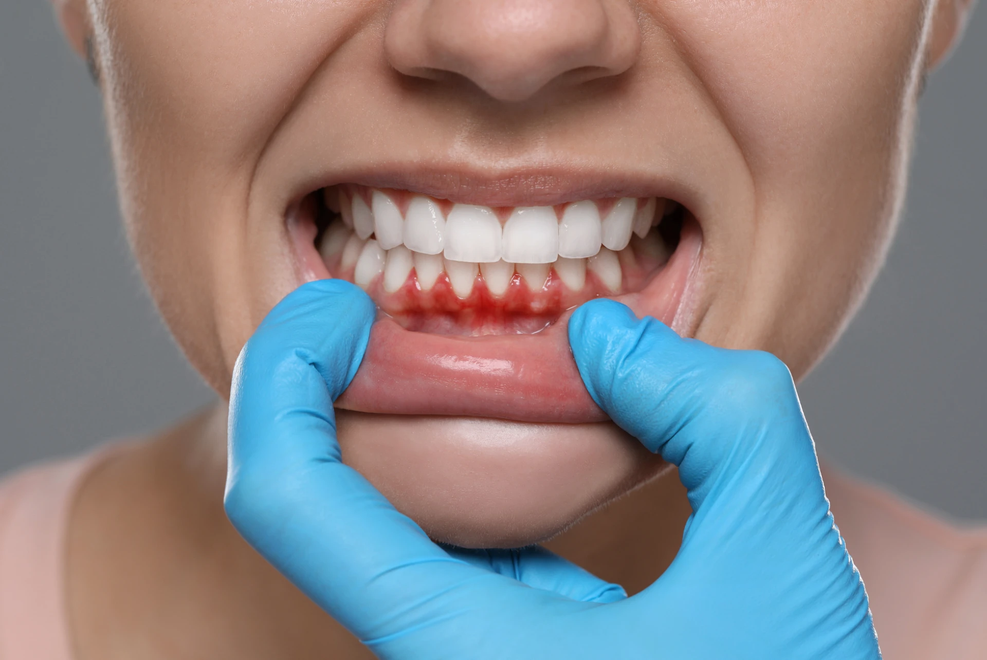 Preventive Cooloongup Dental Care: Why Regular Check-Ups Matter