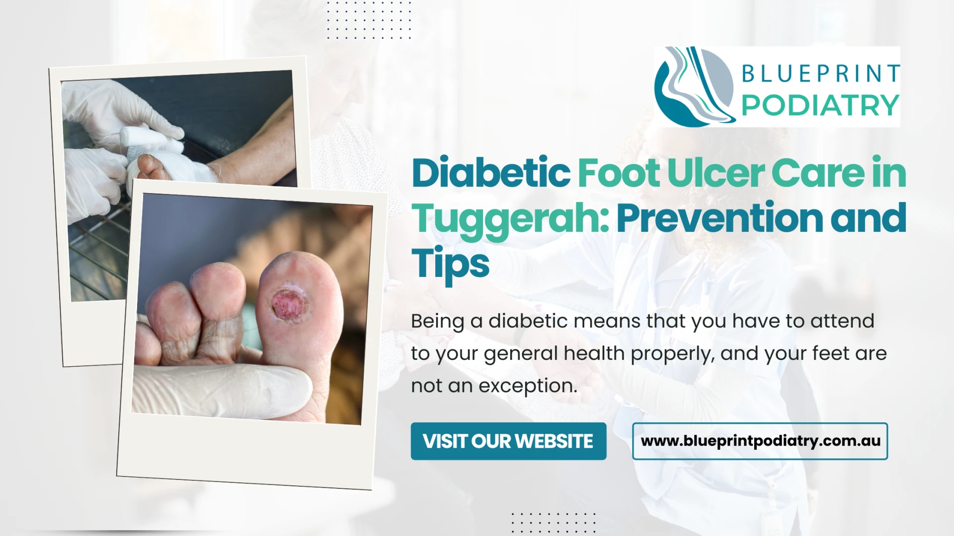 Diabetic Foot Ulcer Care in Tuggerah: Prevention and Tips