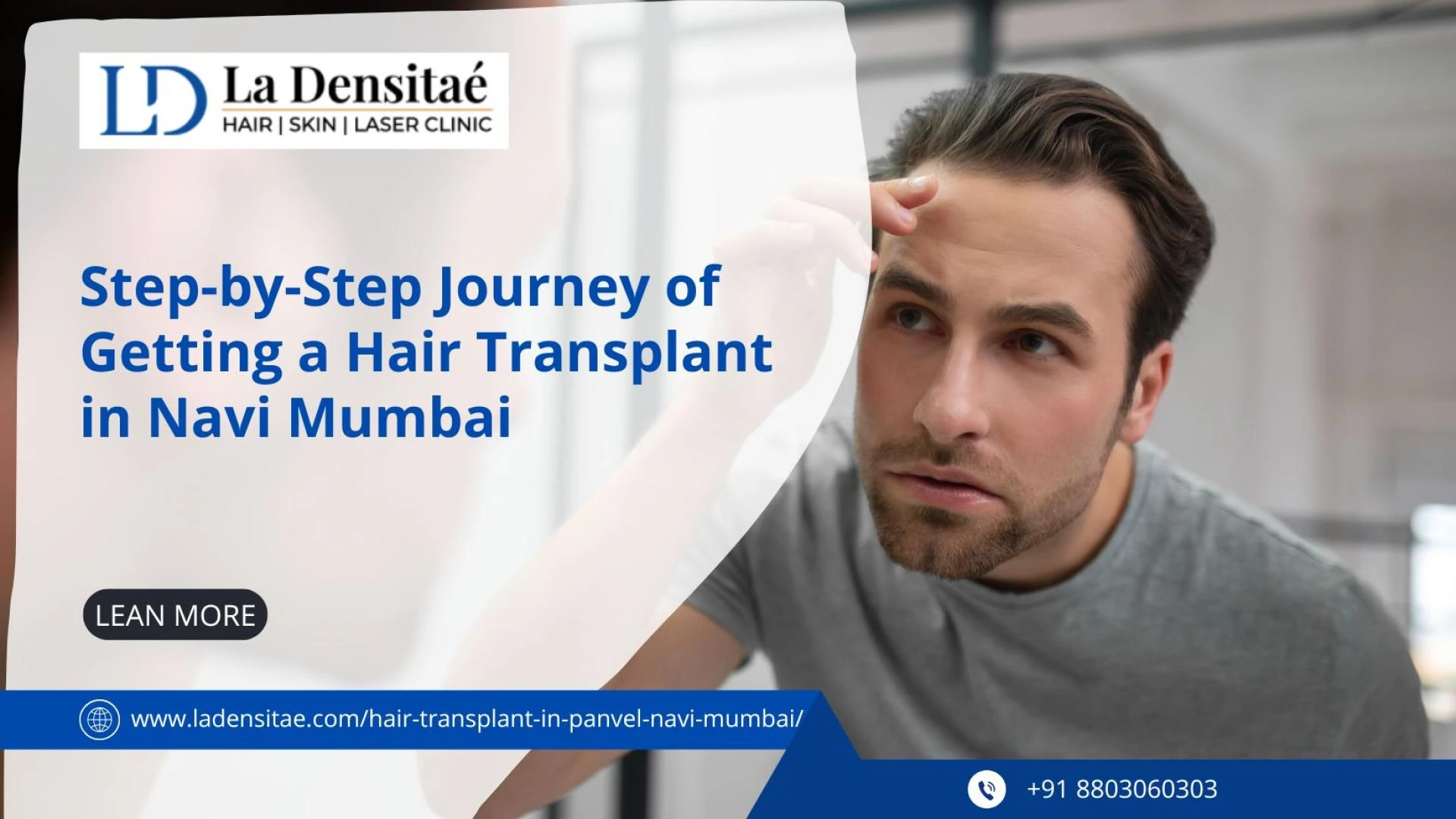 Step-by-Step Journey of Getting a Hair Transplant in Navi Mumbai