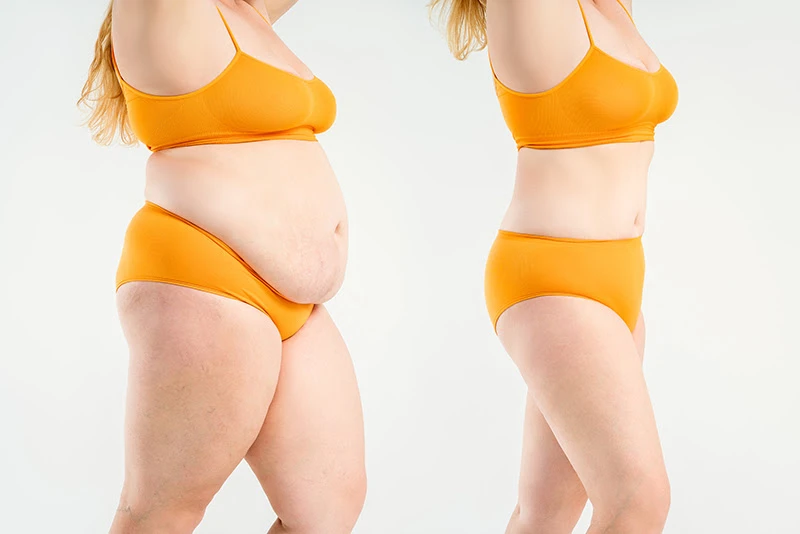 Buy GLP-1 + GIP (Tirzepatide) & GLP-1 Semaglutide | USA Phentermine