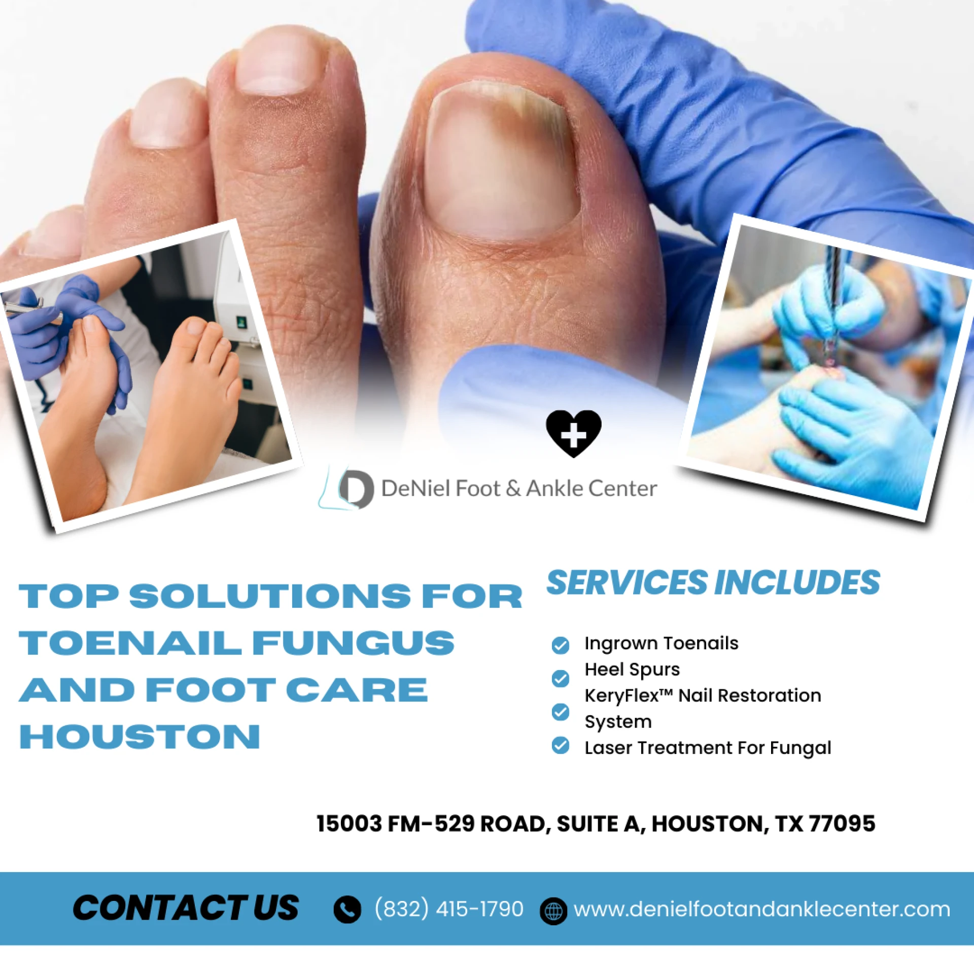 Top Solutions for Toenail Fungus and Foot Care Houston