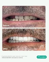 Andent Dental Clinic: Your Journey to a Confident Smile in Tirana.