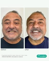Andent Dental Clinic: Your Journey to a Confident Smile in Tirana.