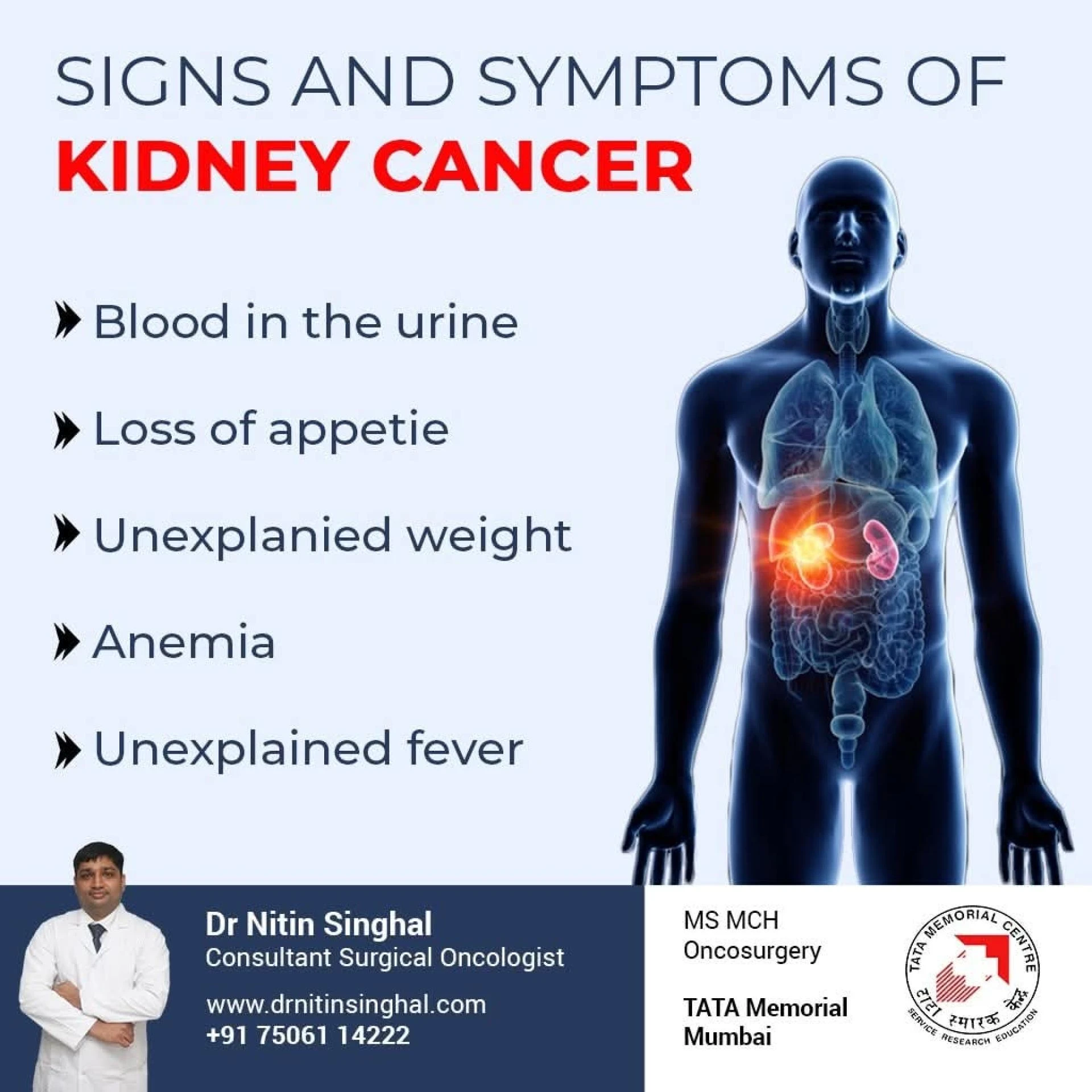 Breakthroughs in Kidney Cancer Treatment: What Patients Should Know in 2025
