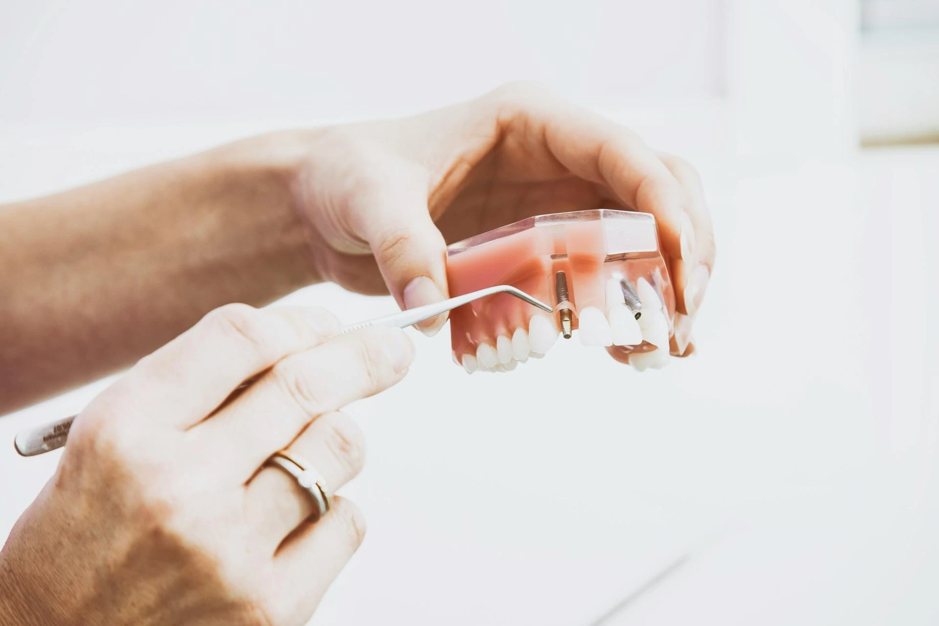 Complete Guide to Fillings for Teeth: Types of Fillings and Dental Filling Cost