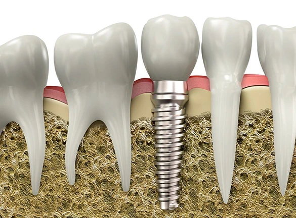 Why Choosing the Right Dentist in Ahmedabad Can Save You Money and Pain