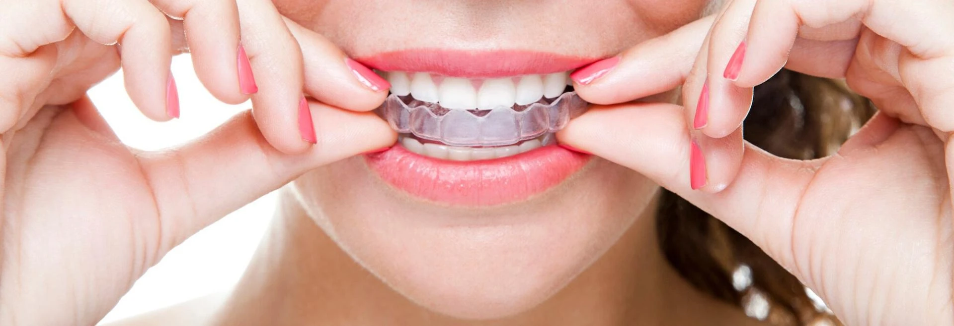 Why Choosing the Right Dentist in Ahmedabad Can Save You Money and Pain