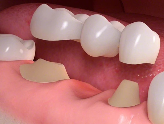 Why Choosing the Right Dentist in Ahmedabad Can Save You Money and Pain