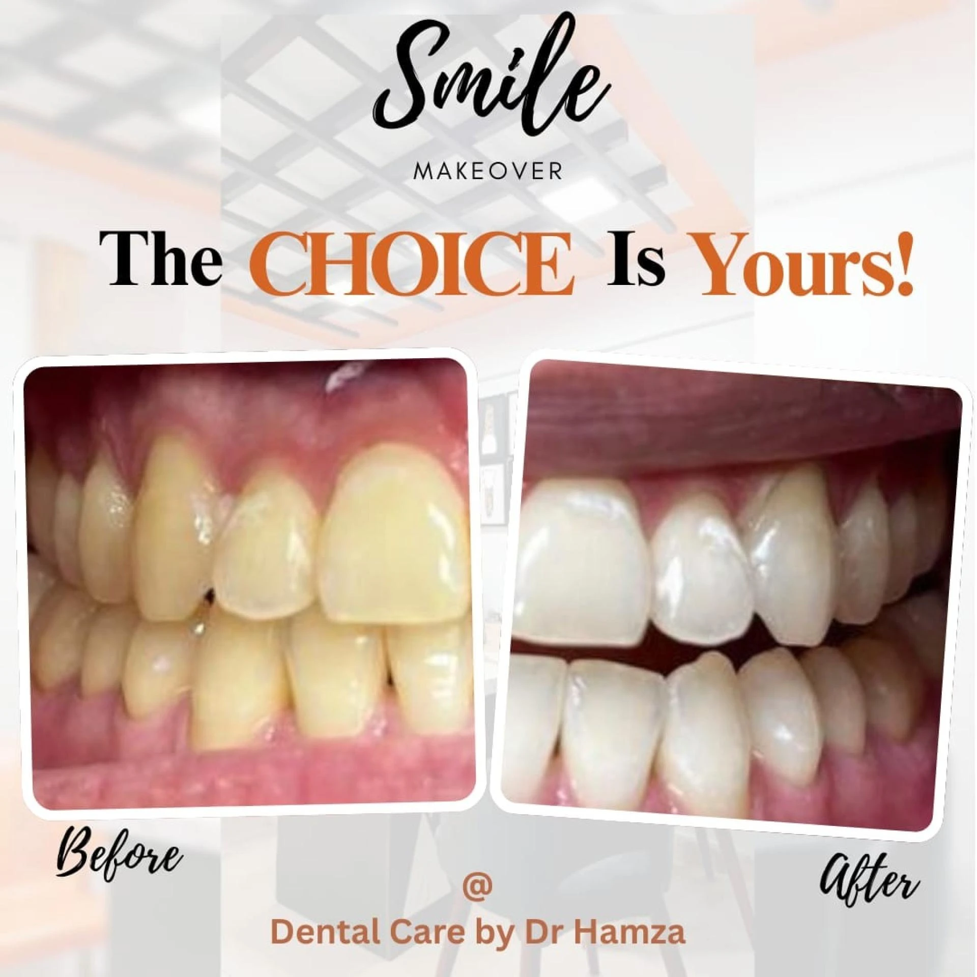 Smile Makeovers in Pakistan:  How Cosmetic Dentistry is Becoming the New Normal