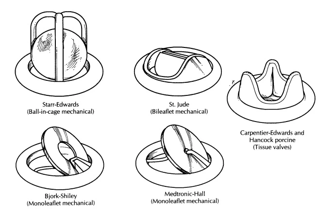 Prosthetic Heart Valves Market Expansion Accelerated by Breakthroughs in Valve Design and Implantation
