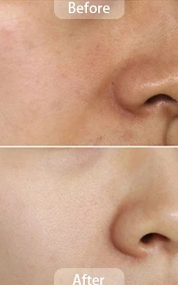 Skin Care and Facial Rejuvenation Treatment