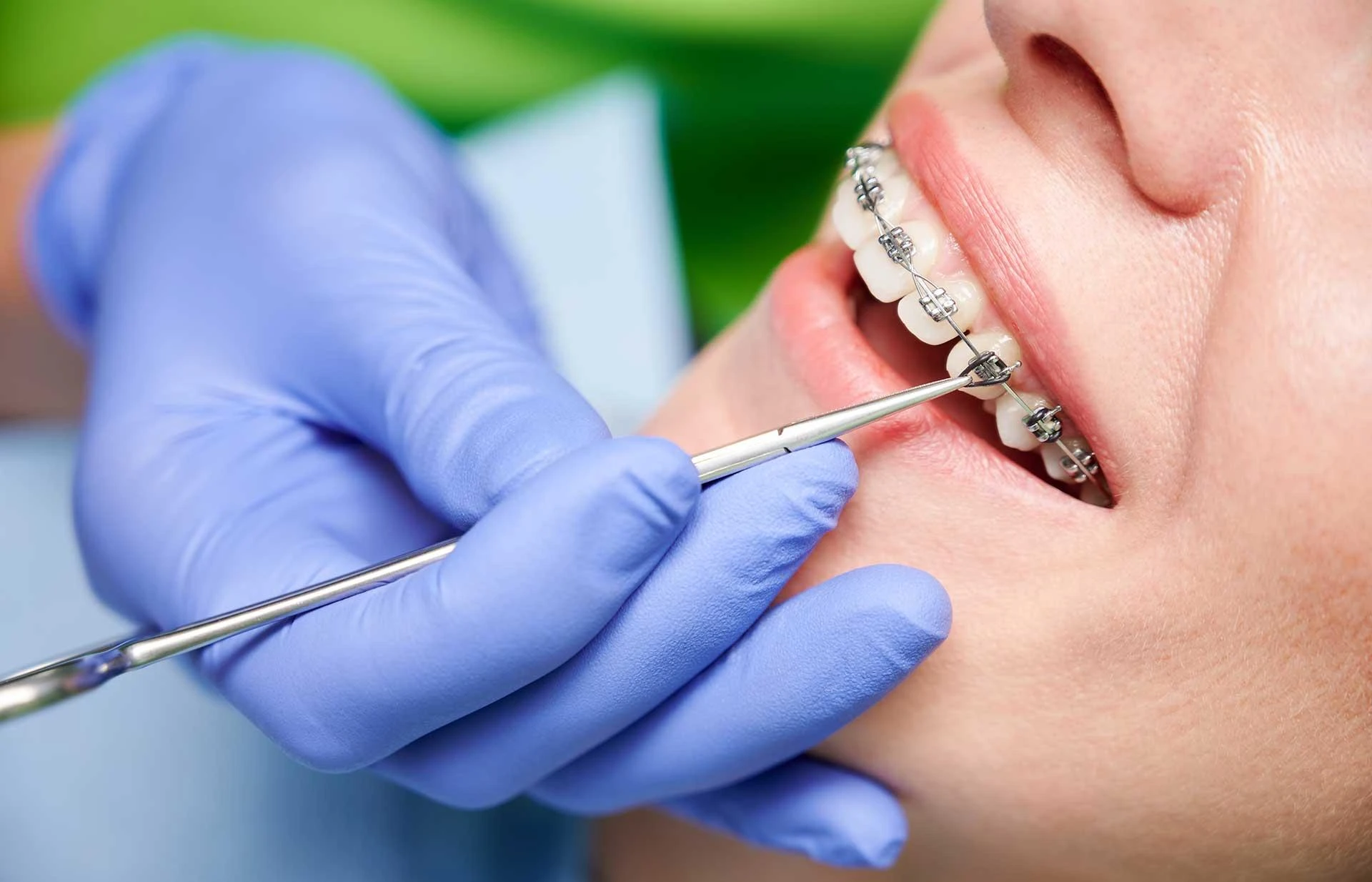 When Is Orthodontic Tooth Uncovering Recommended by Dentists?