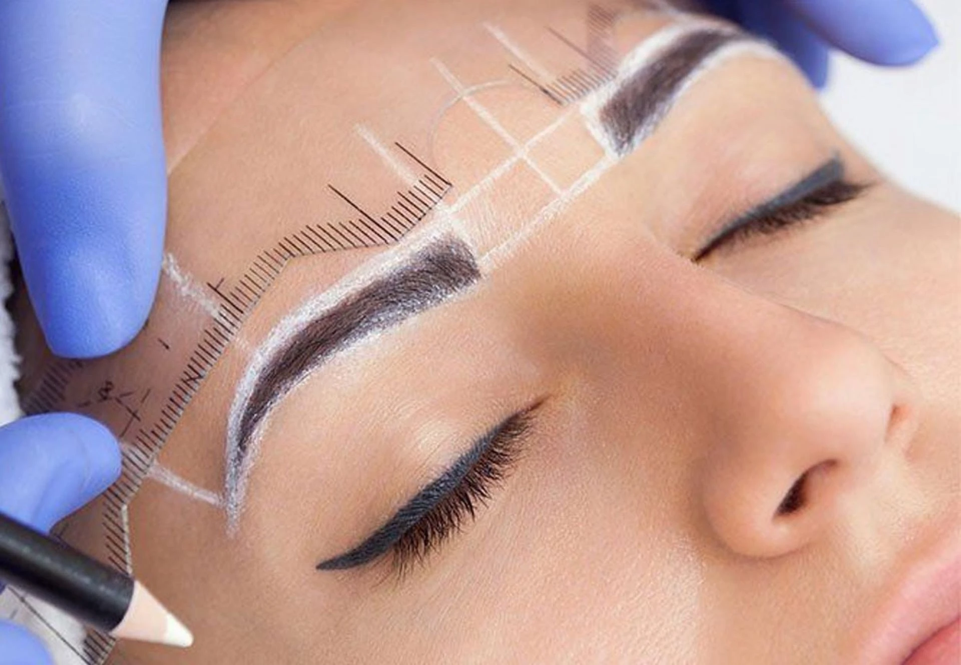 Is Eyebrow Transplant in Turkey Worth It? Here’s What You Should Know