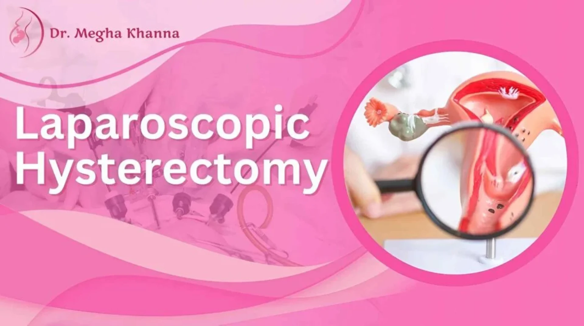 Preparing for Laparoscopic Fibroid Surgery – Your Guide from the Best Lady Gynecologist in Kolkata