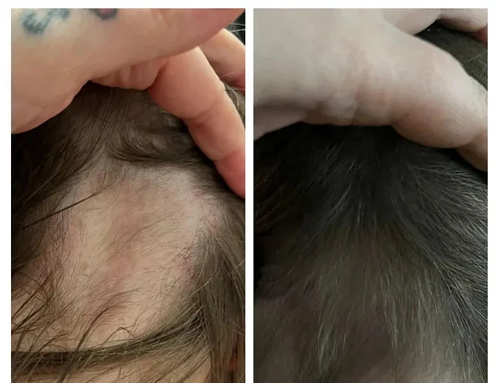 What Vitamins Are Good for Hair Growth (and Why Gut Health Matters More Than You Think)