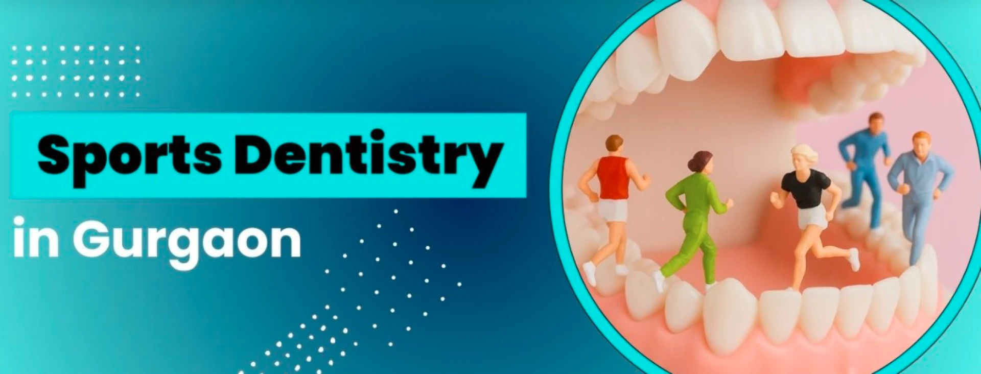 Everything You Need to Know About Sports Guard Treatment in Gurgaon