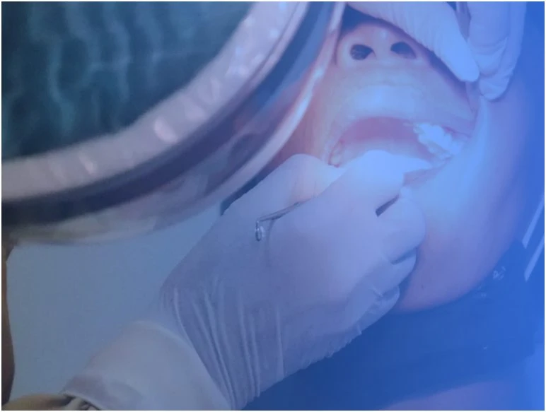 4 Critical Signs that Need Immediate Dental Attention