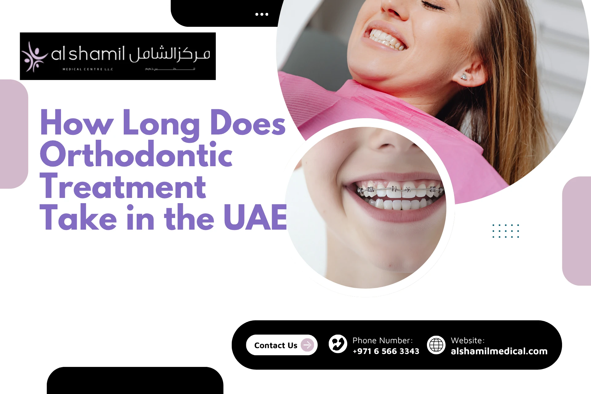 How Long Does Orthodontic Treatment Take in the UAE