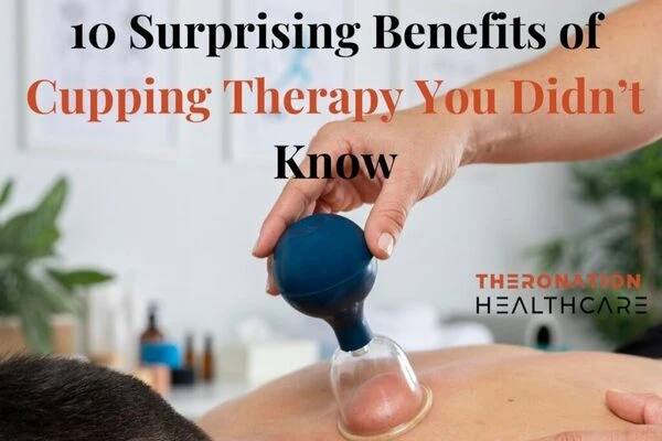 10 Surprising Benefits of Cupping Therapy You Didn’t Know