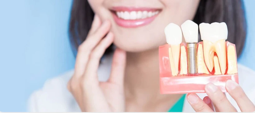 Tooth Implant Delhi – Restore Your Smile with Advanced Dental Solutions