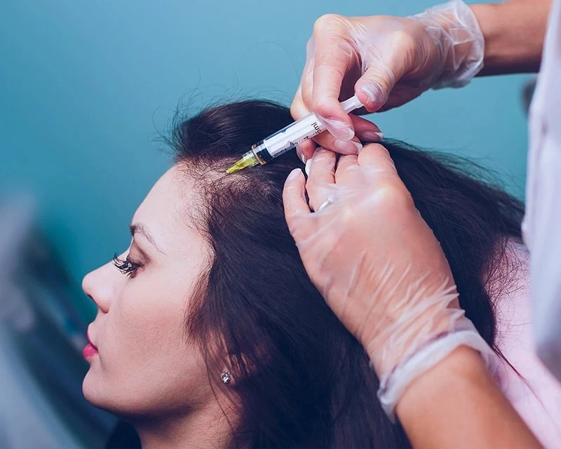 Plasma Hair Treatment: Why Professional PRP Hair Treatment Works Better Than Home Remedies