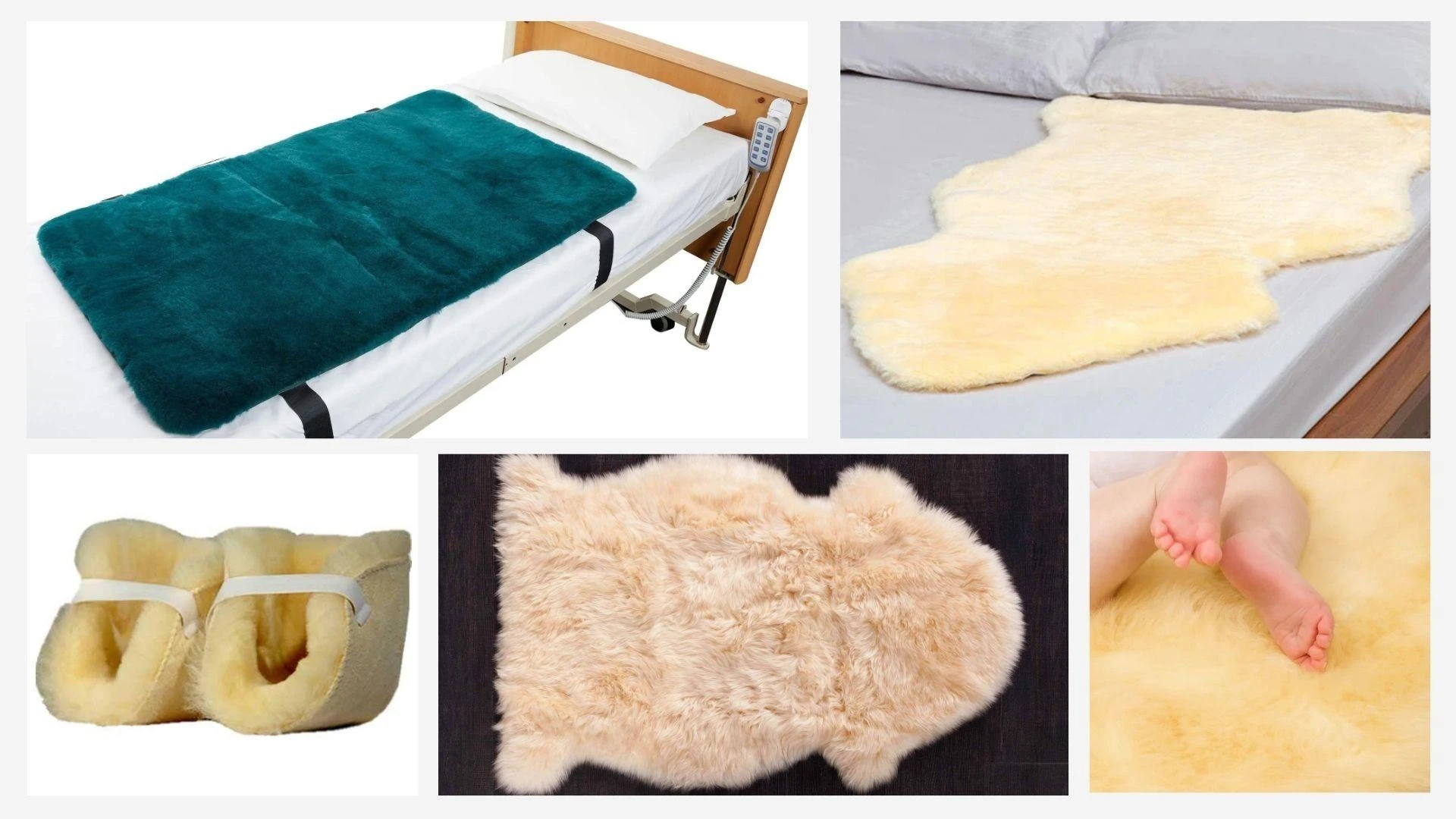 Medical Sheepskin for Post-Surgery Recovery: Does It Help?