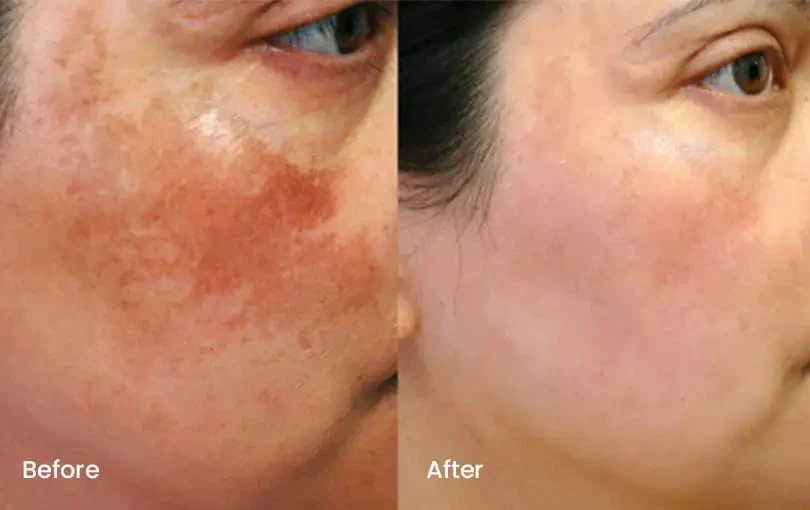 Top Dermatologist in Sheikhupura – Expert Skin Care at The Health Studio