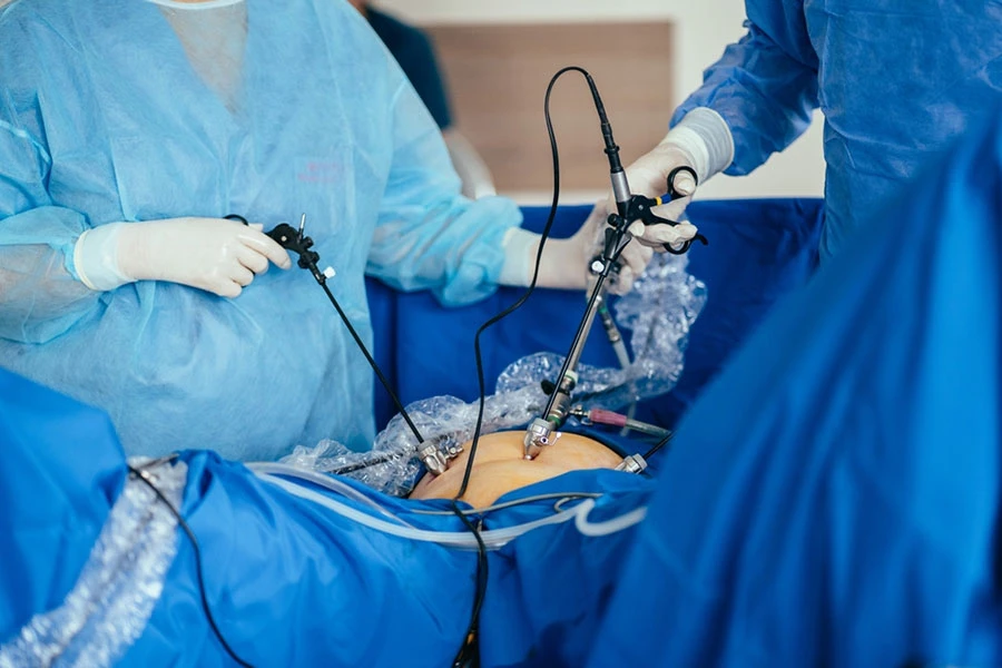 Best Laparoscopic Surgeon in Indore and Laparoscopy Cost in Indore: Expert Care with Dr. Poonam Raikwar