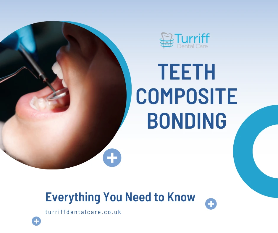 Everything You Need to Know About Teeth Composite Bonding Before Booking !